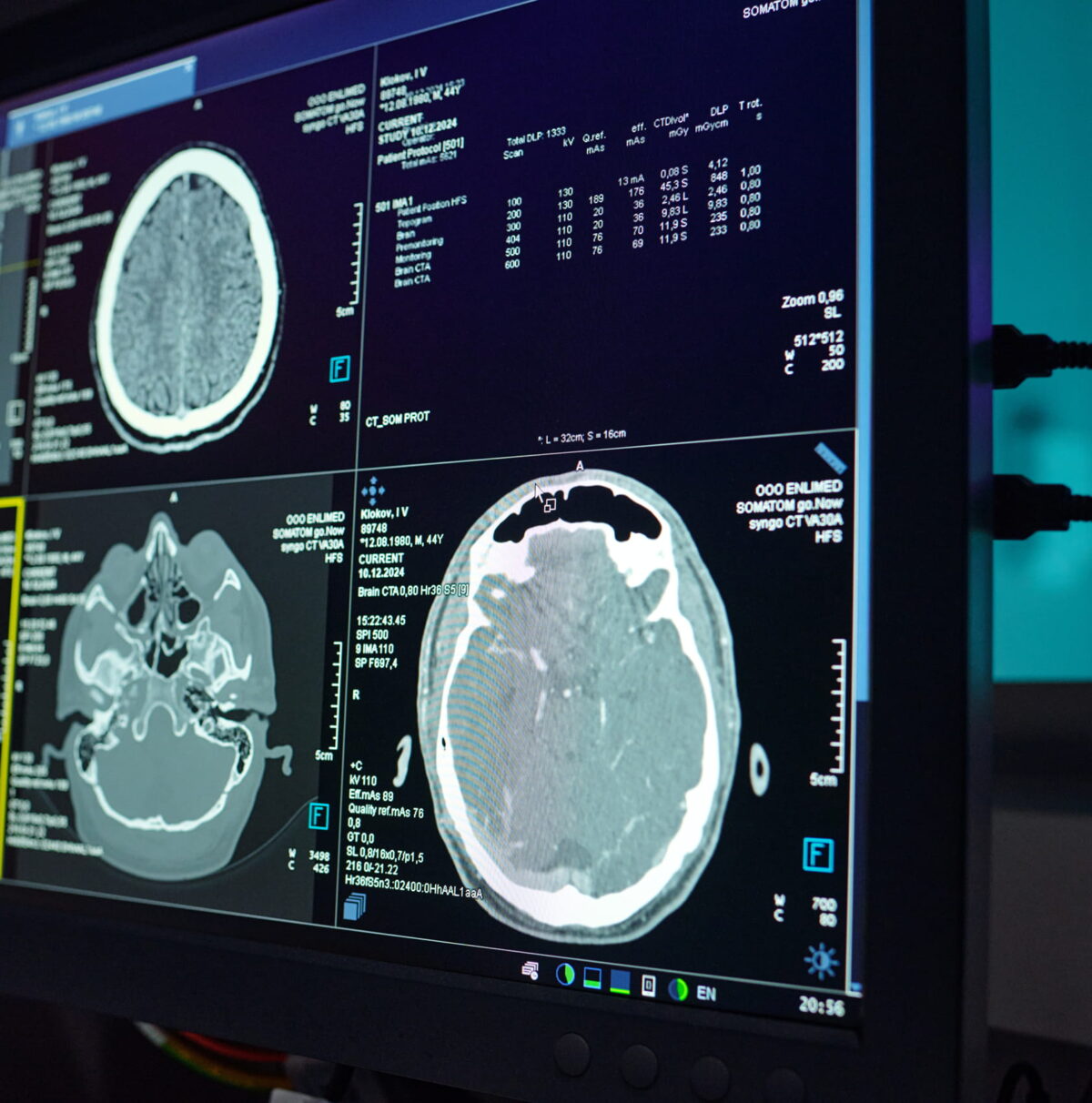 AI radiology platform