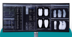 AI radiology pltform