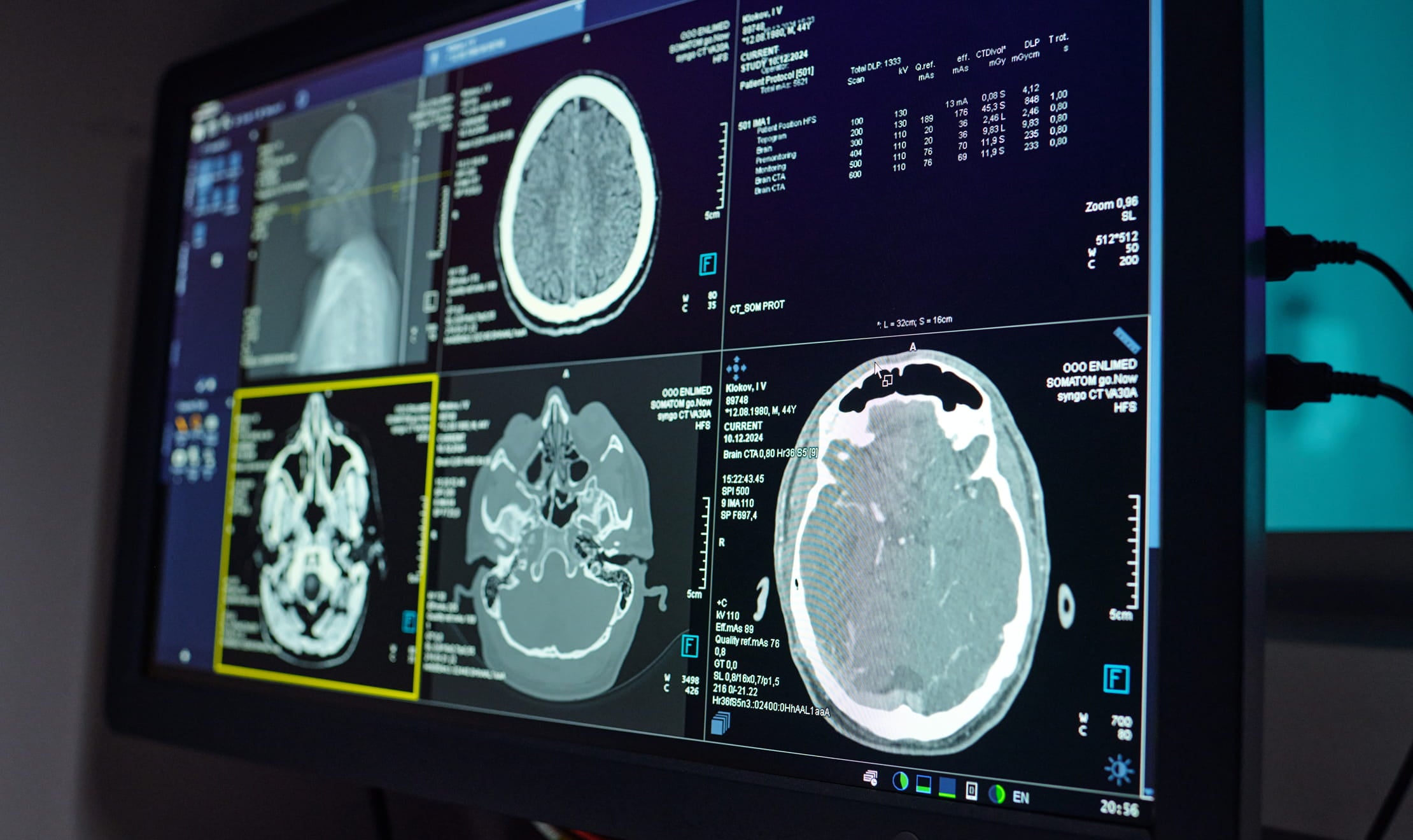 AI radiology departmet