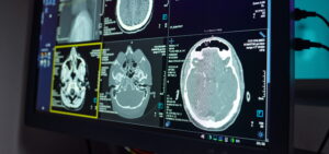 AI Radiology Platform