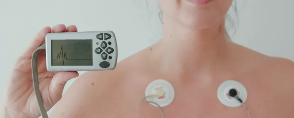 Cardiac monitoring